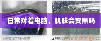 日常对着电脑，肌肤会变黑吗