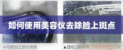 如何使用美容仪去除脸上斑点