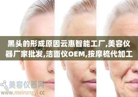 黑头的形成原因云惠智能工厂,美容仪器厂家批发,洁面仪OEM,按摩梳代加工