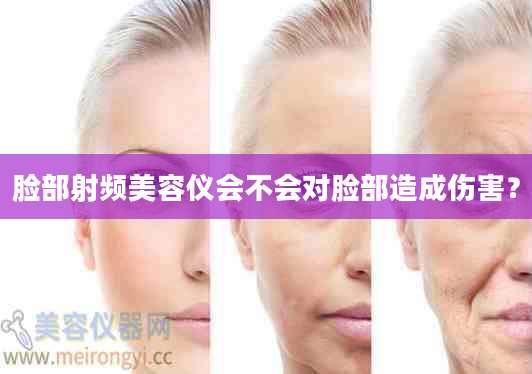 脸部射频美容仪会不会对脸部造成伤害?